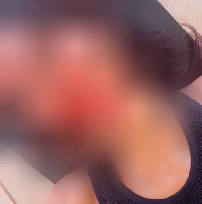 Morena, 29 anni